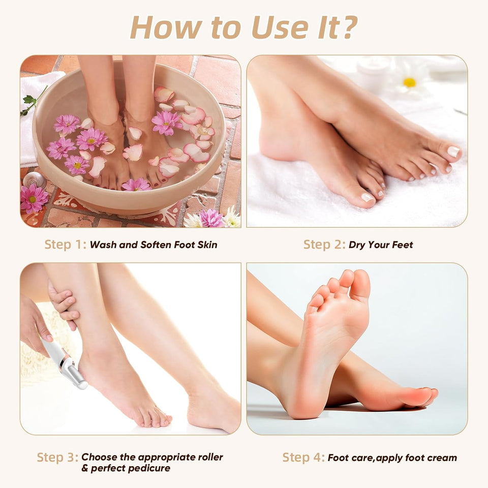 Electric Callus Remover